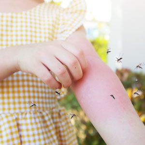 Piojos y repelentes de insectos
